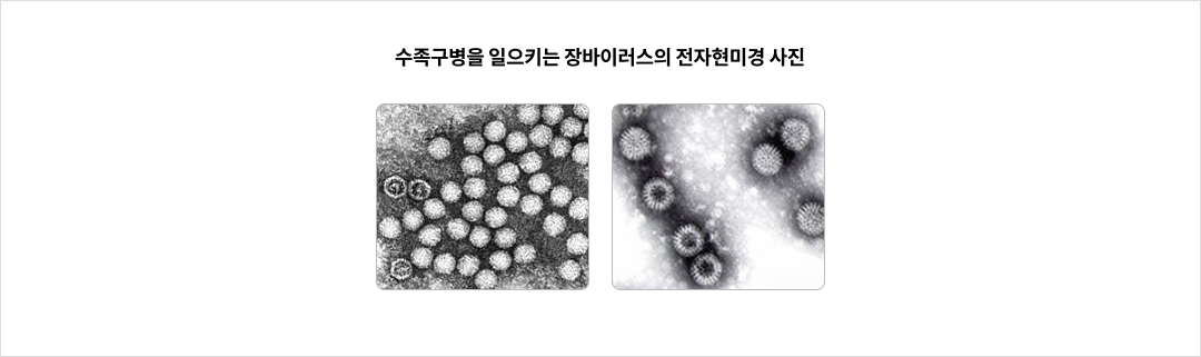 수족구병을 일으키는 장바이러스의 전자현미경 사진